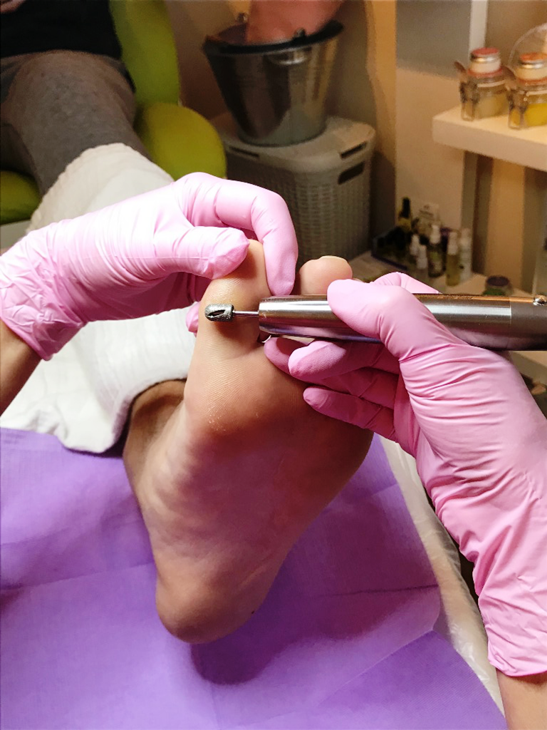 Philadelphia rots Zachte voeten Korte pedicure behandeling - Feetcare Monique
